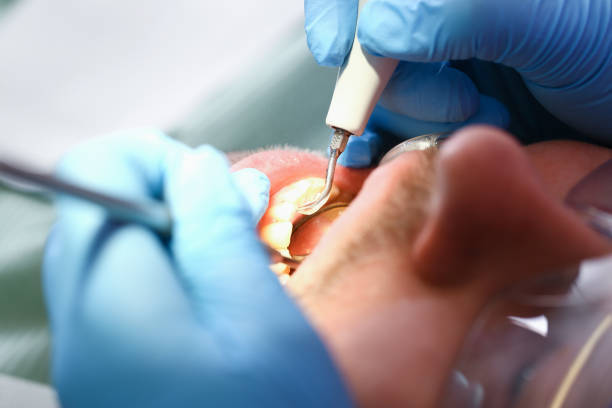 Best Emergency Treatment for Dental Infections or Abscesses in Ester, AK